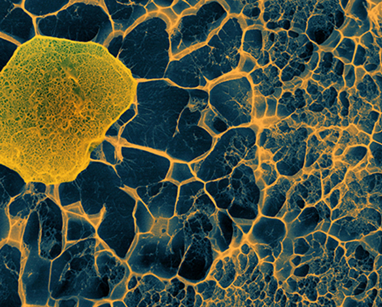 سلول‌های بنیادی: فرار هنرمندان بدجنس از یک بیماری نادر